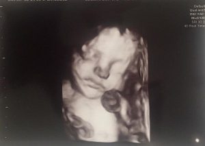 ecografie roxana 2 r